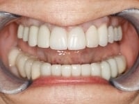 Konig Center for Cosmetic & Comprehensive Dentistry smile photos